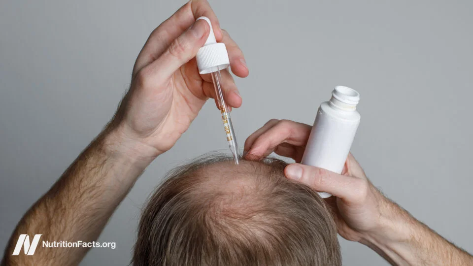 Finasteride and Minoxidil for Hair Loss: Benefits, Risks and Evidence Limits